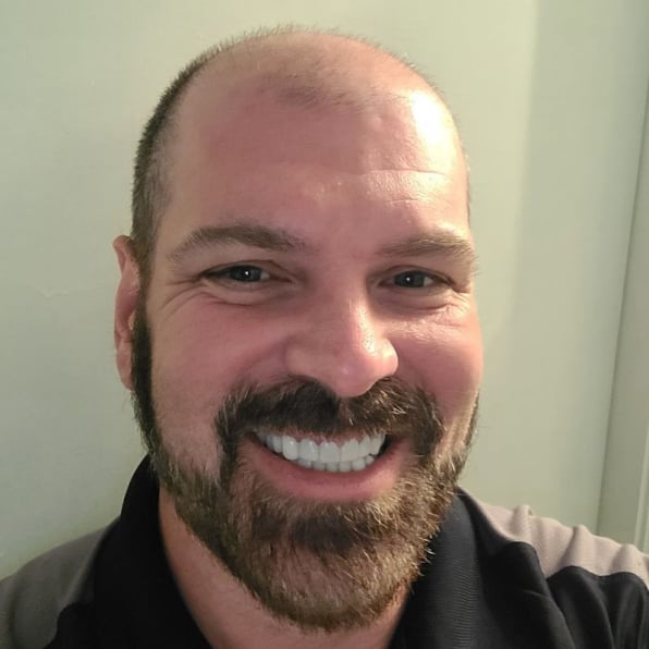 Shiny Smile Veneers Reviews 1