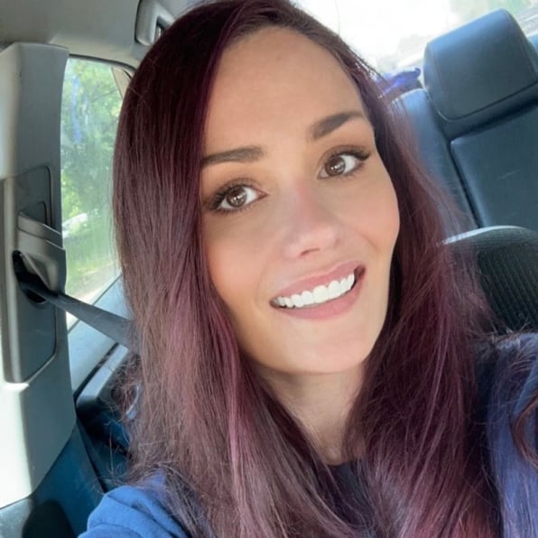 Shiny Smile Veneers Reviews 2